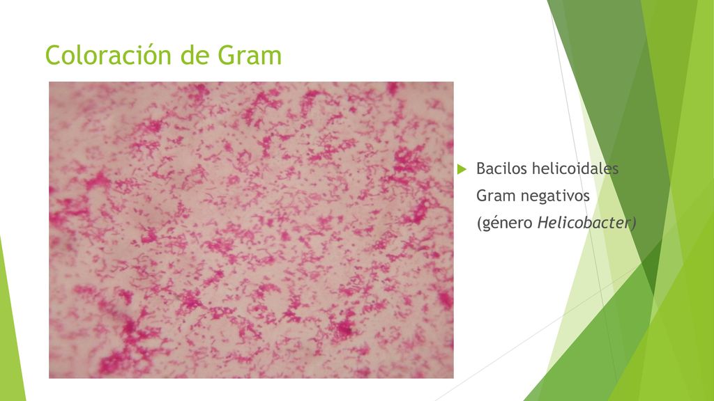 Coloración de Gram Bacilos helicoidales Gram negativos