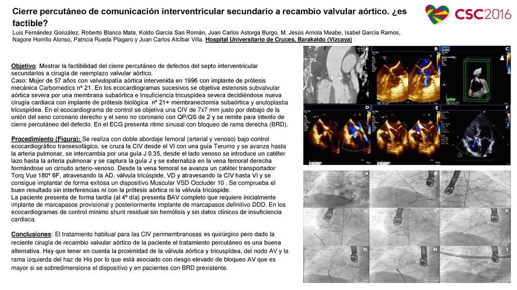 Cierre percutáneo de comunicación interventricular secundario a recambio valvular aórtico. ¿es factible