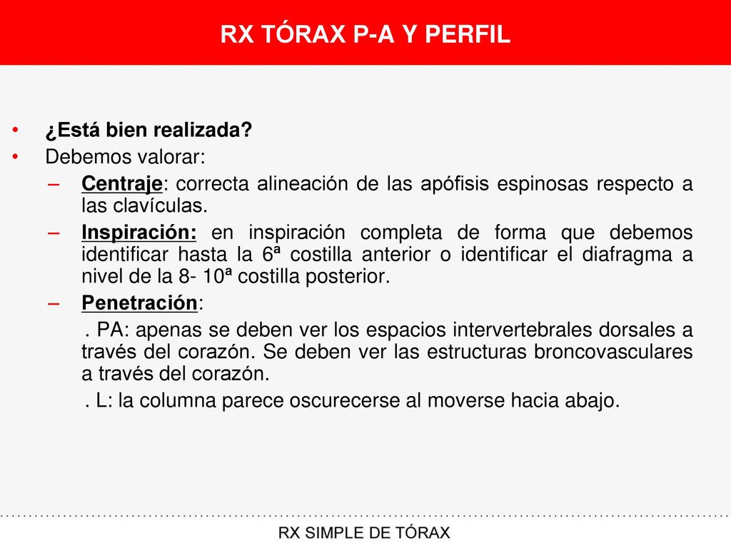 RX TÓRAX P-A Y PERFIL ¿Está bien realizada Debemos valorar: