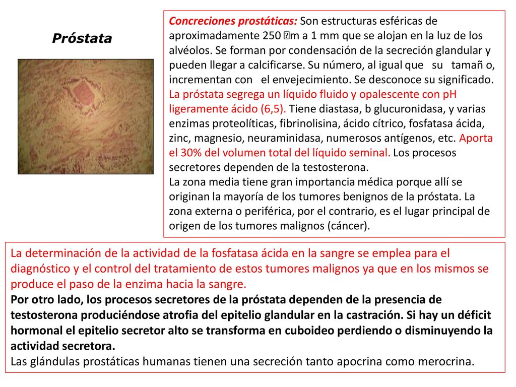 Concreciones prostáticas: Son estructuras esféricas de aproximadamente 250 m a 1 mm que se alojan en la luz de los alvéolos. Se forman por condensación de la secreción glandular y pueden llegar a calcificarse. Su número, al igual que su tamañ o, incrementan con el envejecimiento. Se desconoce su significado.