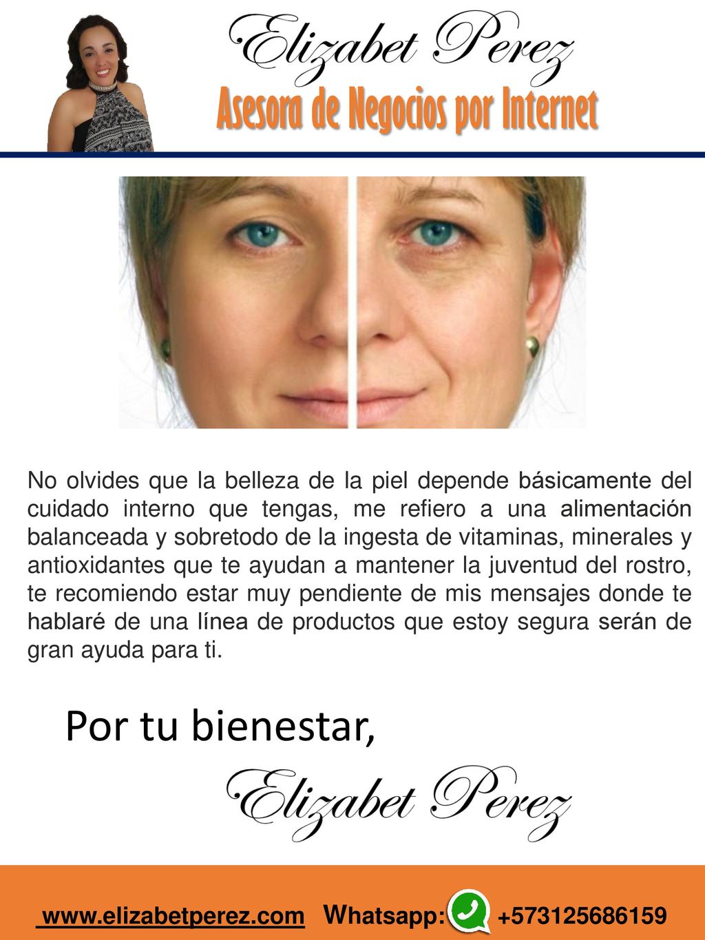 No olvides que la belleza de la piel depende básicamente del cuidado interno que tengas, me refiero a una alimentación balanceada y sobretodo de la ingesta de vitaminas, minerales y antioxidantes que te ayudan a mantener la juventud del rostro, te recomiendo estar muy pendiente de mis mensajes donde te hablaré de una línea de productos que estoy segura serán de gran ayuda para ti.