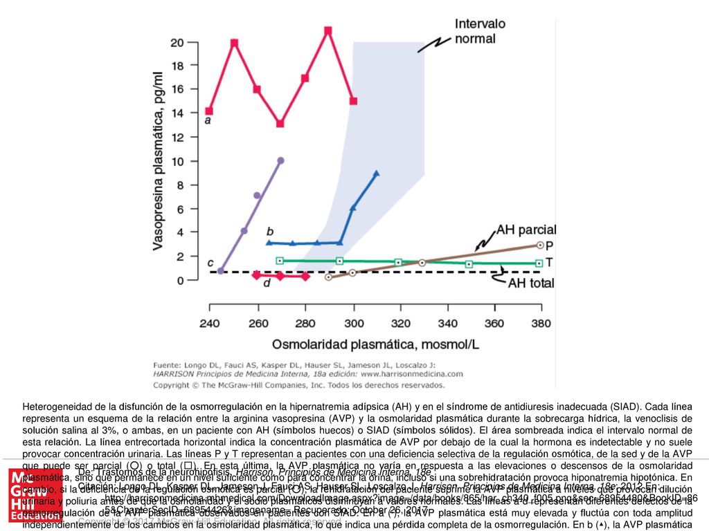 Heterogeneidad de la disfunción de la osmorregulación en la hipernatremia adípsica (AH) y en el síndrome de antidiuresis inadecuada (SIAD). Cada línea representa un esquema de la relación entre la arginina vasopresina (AVP) y la osmolaridad plasmática durante la sobrecarga hídrica, la venoclisis de solución salina al 3%, o ambas, en un paciente con AH (símbolos huecos) o SIAD (símbolos sólidos). El área sombreada indica el intervalo normal de esta relación. La línea entrecortada horizontal indica la concentración plasmática de AVP por debajo de la cual la hormona es indetectable y no suele provocar concentración urinaria. Las líneas P y T representan a pacientes con una deficiencia selectiva de la regulación osmótica, de la sed y de la AVP que puede ser parcial (○) o total (□). En esta última, la AVP plasmática no varía en respuesta a las elevaciones o descensos de la osmolaridad plasmática, sino que permanece en un nivel suficiente como para concentrar la orina, incluso si una sobrehidratación provoca hiponatremia hipotónica. En cambio, si la deficiencia de la regulación osmótica es parcial (○), la rehidratación del paciente suprime la AVP plasmática a niveles que provocan dilución urinaria y poliuria antes de que la osmolaridad y el sodio plasmáticos disminuyan a valores normales. Las líneas a-d representan diferentes defectos de la osmorregulación de la AVP plasmática observados en pacientes con SIAD. En a (▪), la AVP plasmática está muy elevada y fluctúa con toda amplitud independientemente de los cambios en la osmolaridad plasmática, lo que indica una pérdida completa de la osmorregulación. En b (▴), la AVP plasmática permanece fija a un nivel ligeramente elevado hasta que la osmolaridad plasmática alcanza el intervalo normal, momento en el que comienza a elevarse de forma adecuada, lo que indica que existe un defecto selectivo del componente inhibidor del mecanismo de osmorregulación. En c (•), la AVP plasmática se eleva guardando una estrecha relación con la osmolaridad plasmática incluso antes de que esta última alcance su intervalo normal, lo que indica que existe un reajuste bajo del osmostato. En d (♦), la AVP plasmática parece tener una osmorregulación normal, lo que sugiere que la antidiuresis inadecuada se debe a alguna otra anomalía.