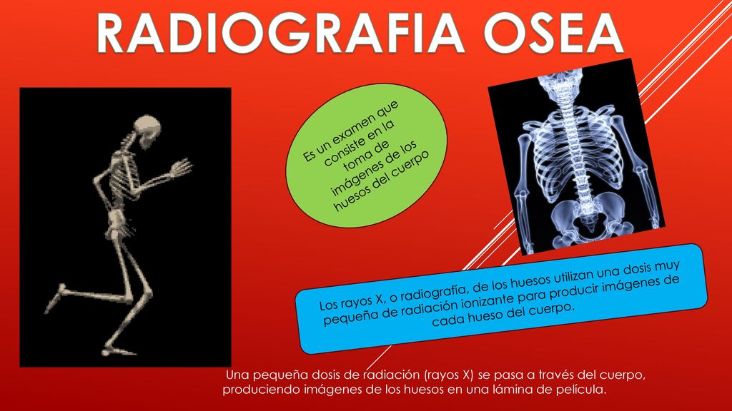 RADIOGRAFIA OSEA Es un examen que consiste en la toma de imágenes de los huesos del cuerpo.