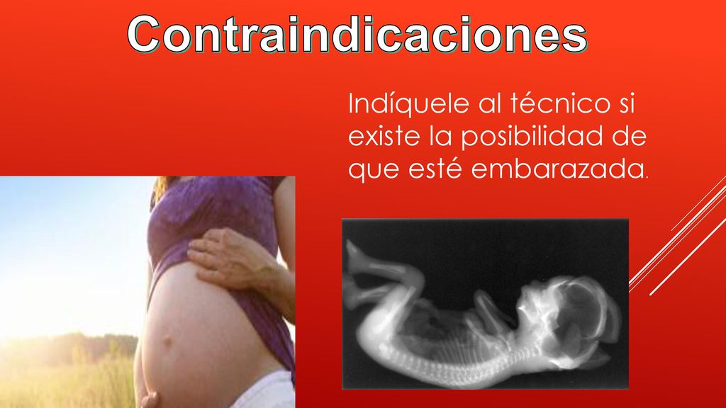 Contraindicaciones Indíquele al técnico si existe la posibilidad de que esté embarazada.