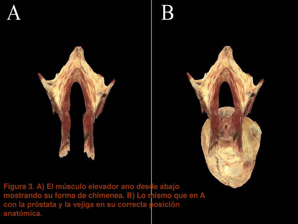 Figura 3. A) El músculo elevador ano desde abajo mostrando su forma de chimenea.