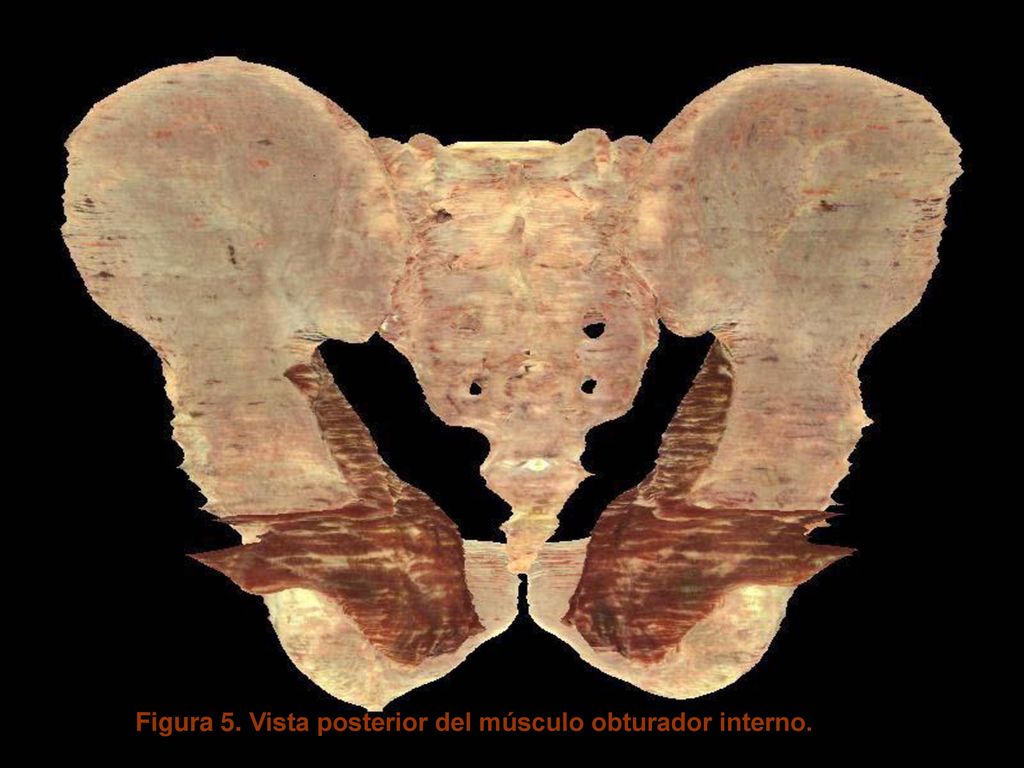 Figura 5. Vista posterior del músculo obturador interno.