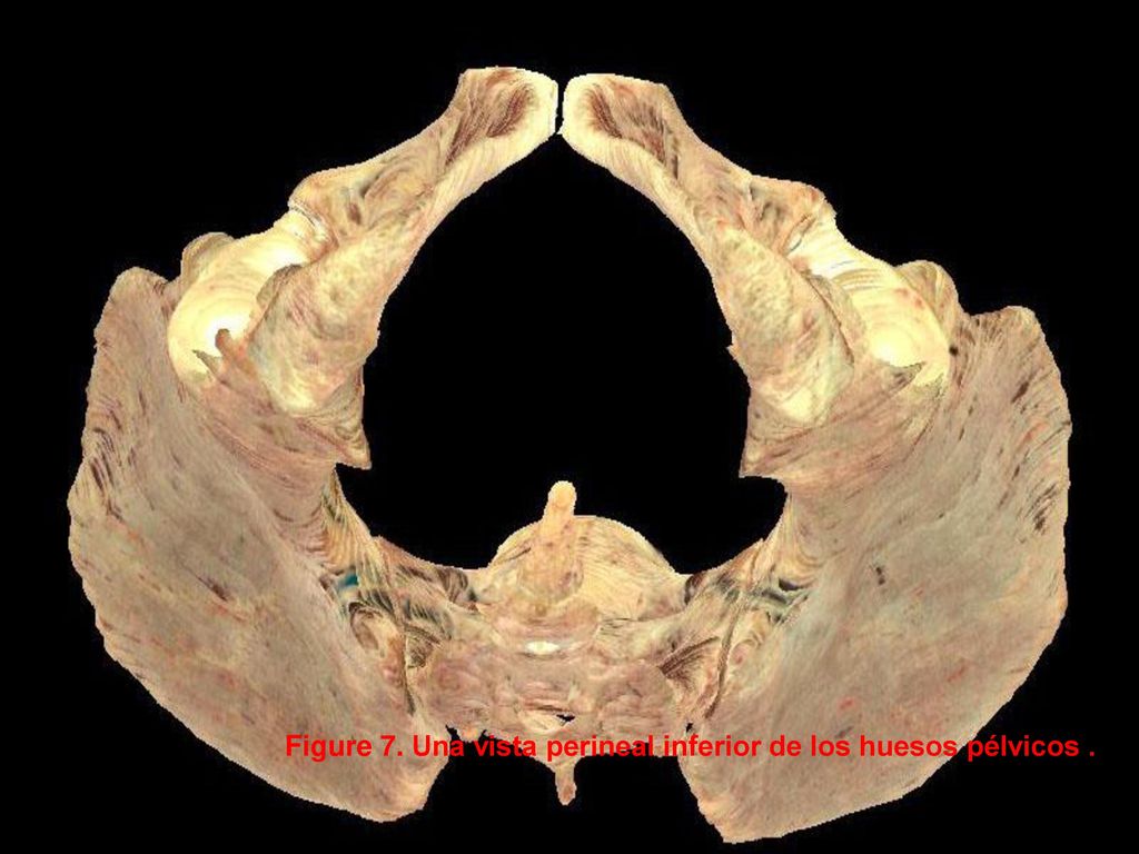 Figure 7. Una vista perineal inferior de los huesos pélvicos .