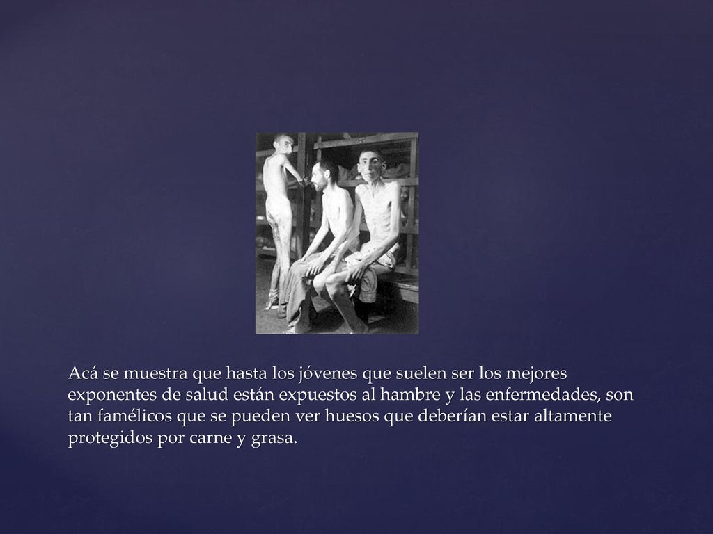 Acá se muestra que hasta los jóvenes que suelen ser los mejores exponentes de salud están expuestos al hambre y las enfermedades, son tan famélicos que se pueden ver huesos que deberían estar altamente protegidos por carne y grasa.