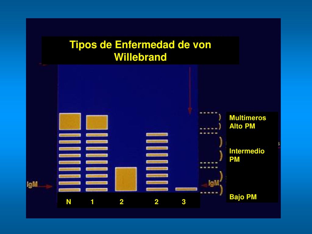 Tipos de Enfermedad de von Willebrand