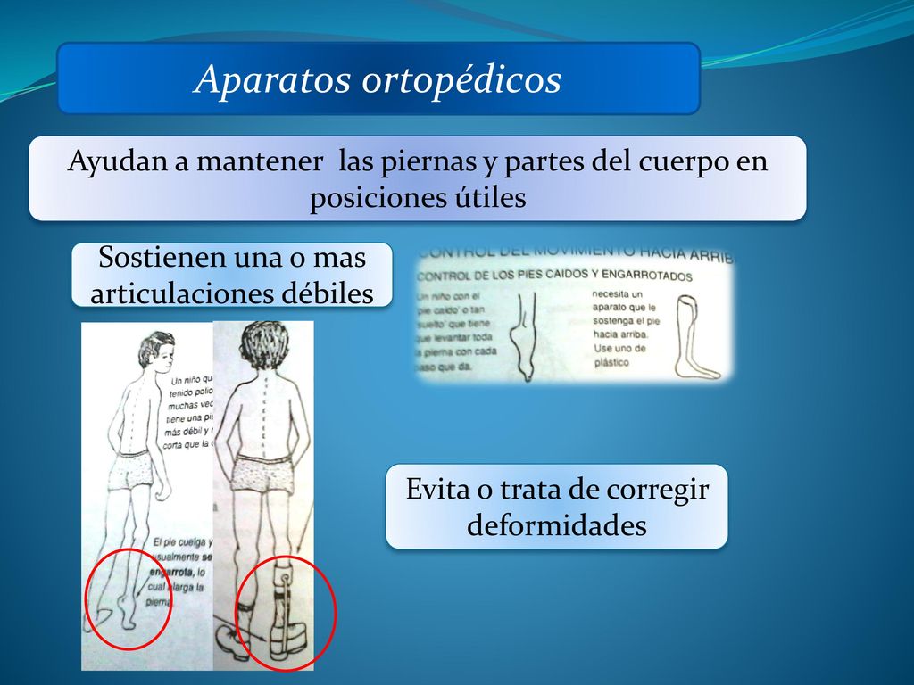 Aparatos ortopédicos Ayudan a mantener las piernas y partes del cuerpo en posiciones útiles. Sostienen una o mas articulaciones débiles.