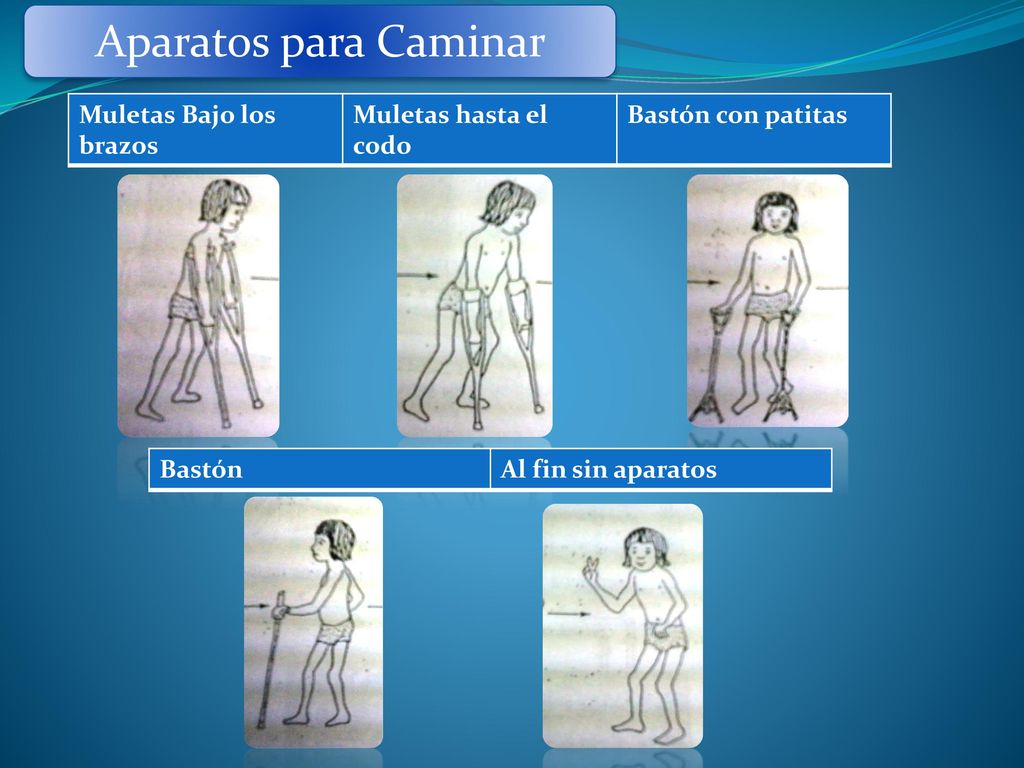 Aparatos para Caminar Muletas Bajo los brazos Muletas hasta el codo