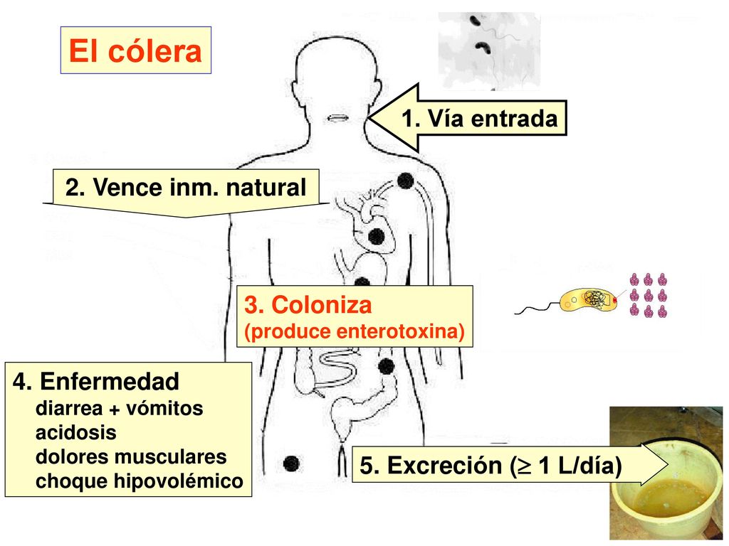 El cólera 1. Vía entrada 2. Vence inm. natural 3. Coloniza