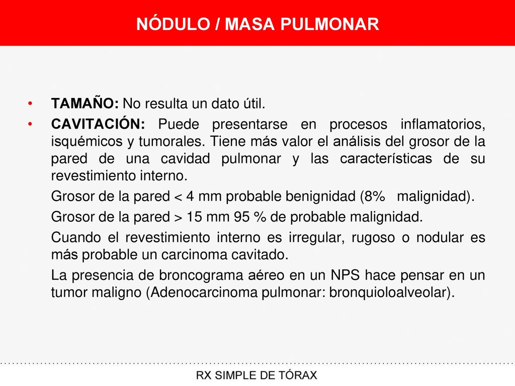 NÓDULO / MASA PULMONAR TAMAÑO: No resulta un dato útil.