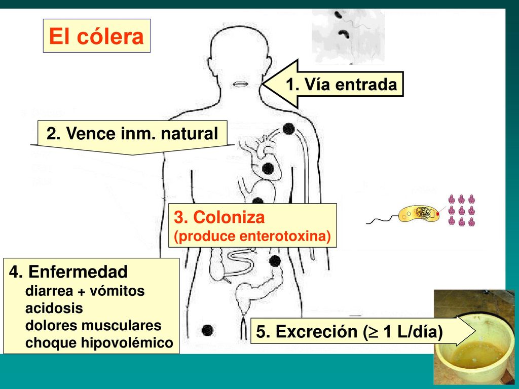 El cólera 1. Vía entrada 2. Vence inm. natural 3. Coloniza
