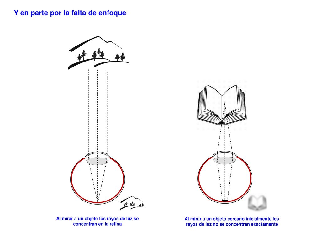Al mirar a un objeto los rayos de luz se concentran en la retina