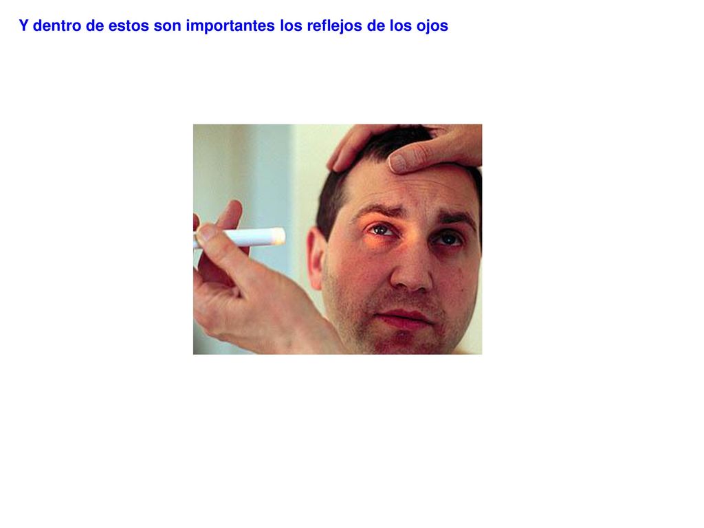 Y dentro de estos son importantes los reflejos de los ojos