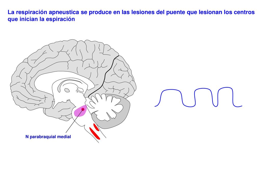 La respiración apneustica se produce en las lesiones del puente que lesionan los centros que inician la espiración