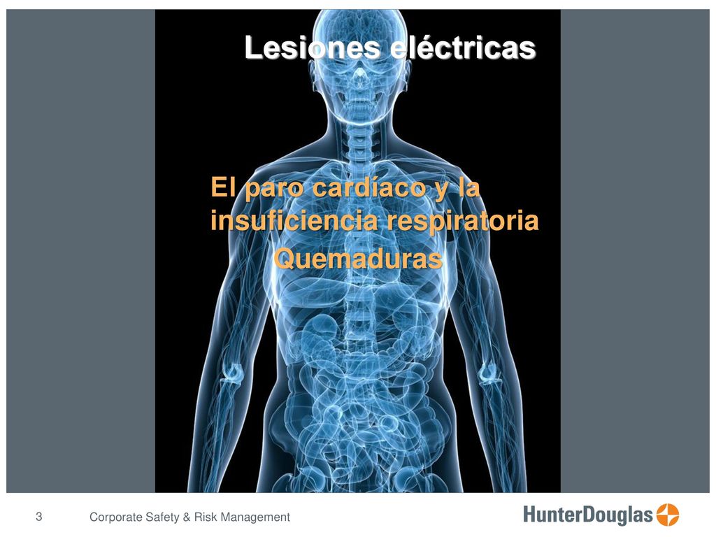 Lesiones eléctricas El paro cardíaco y la insuficiencia respiratoria
