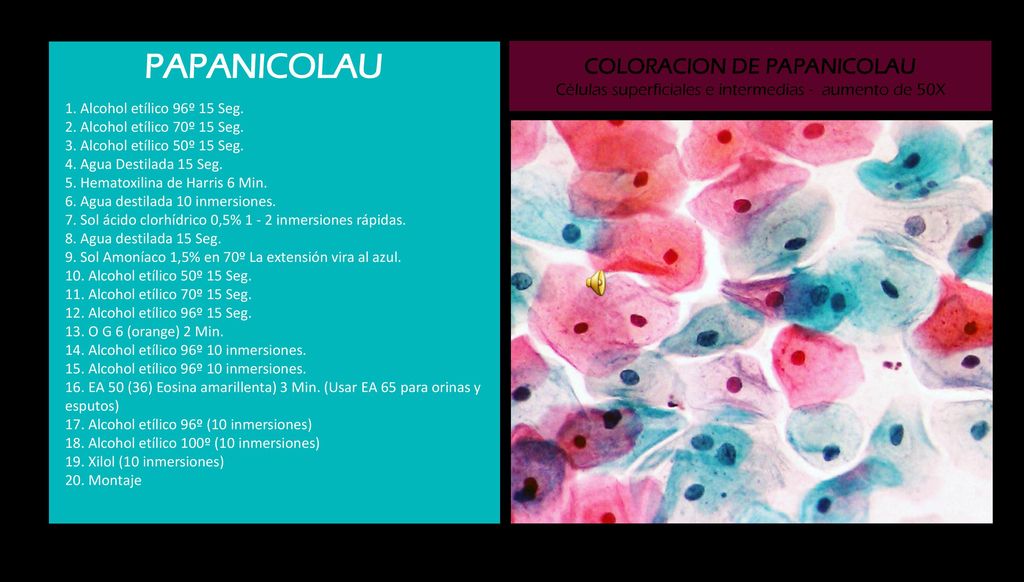 PAPANICOLAU COLORACION DE PAPANICOLAU Células superficiales e intermedias - aumento de 50X.