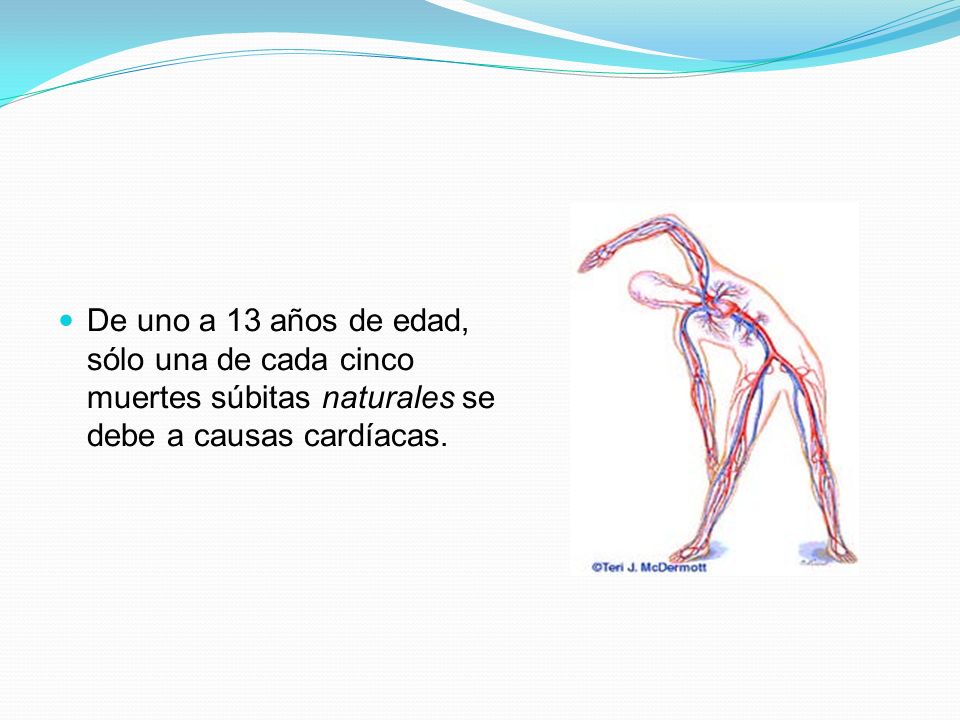 De uno a 13 años de edad, sólo una de cada cinco muertes súbitas naturales se debe a causas cardíacas.