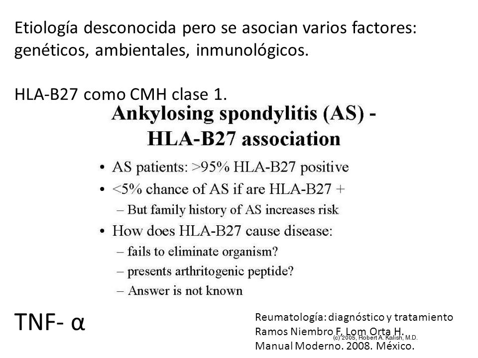 Etiología desconocida pero se asocian varios factores: genéticos, ambientales, inmunológicos.