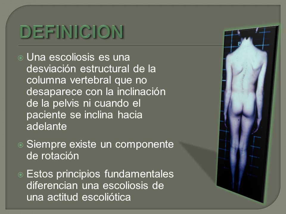 DEFINICION