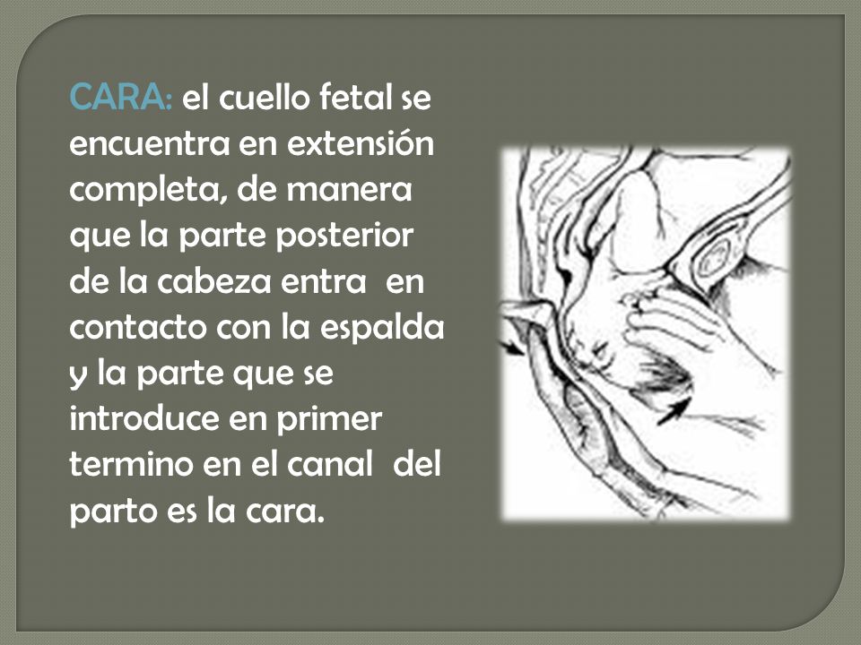 CARA: el cuello fetal se encuentra en extensión completa, de manera que la parte posterior de la cabeza entra en contacto con la espalda y la parte que se introduce en primer termino en el canal del parto es la cara.