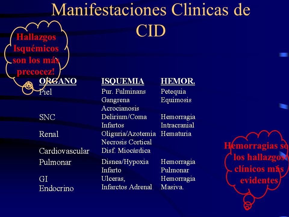 Manifestaciones Clinicas de CID