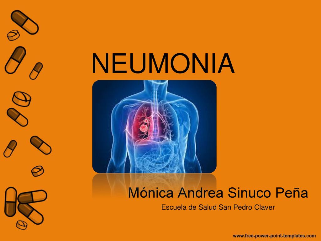 Mónica Andrea Sinuco Peña Escuela de Salud San Pedro Claver