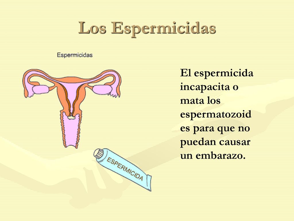 Los Espermicidas El espermicida incapacita o mata los espermatozoides para que no puedan causar un embarazo.