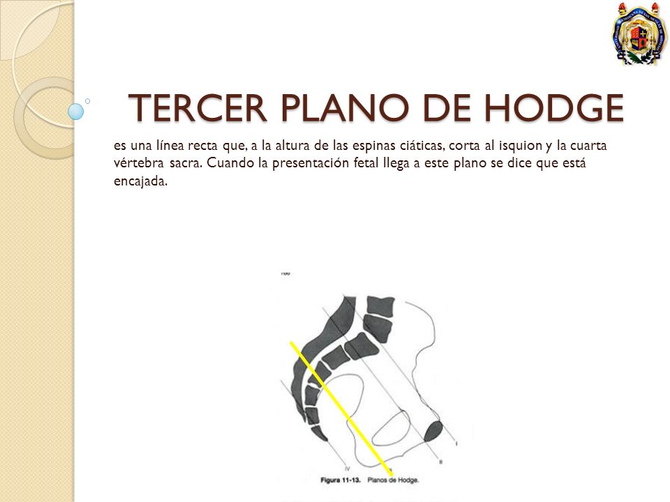 TERCER PLANO DE HODGE