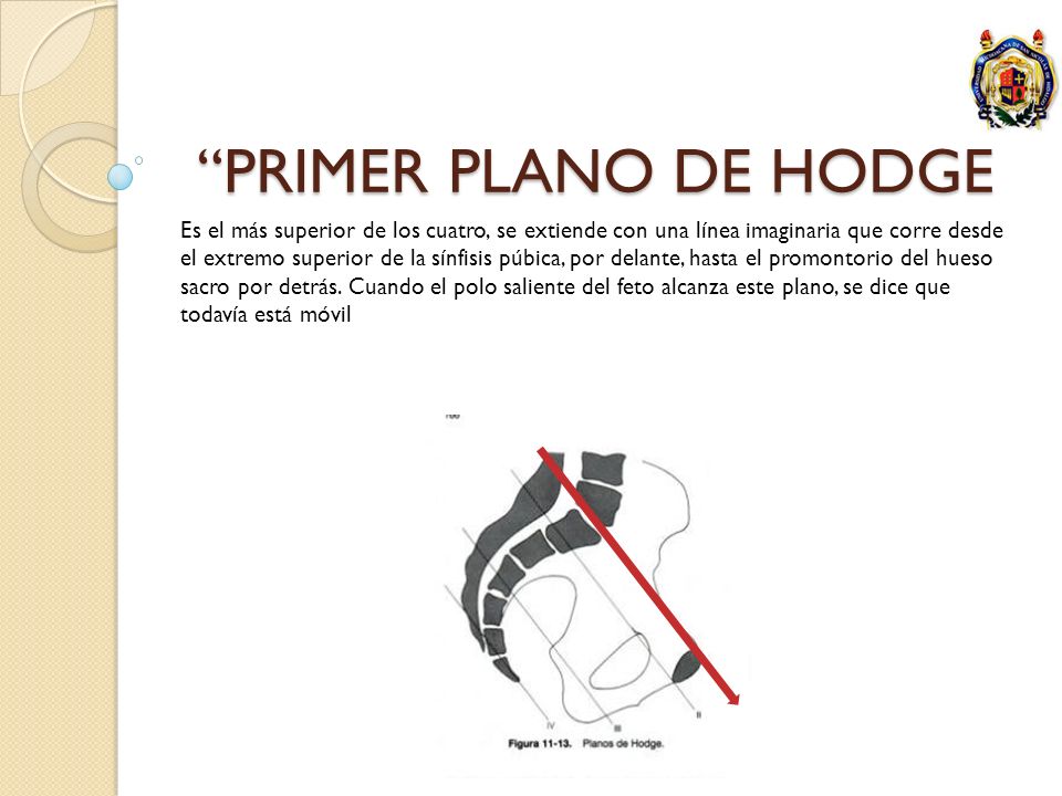 PRIMER PLANO DE HODGE