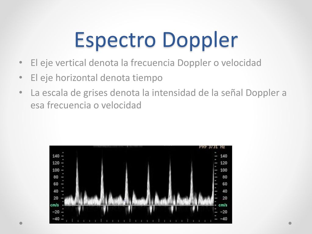 Espectro Doppler El eje vertical denota la frecuencia Doppler o velocidad. El eje horizontal denota tiempo.