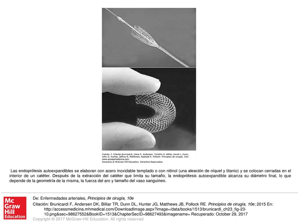 Las endoprótesis autoexpandibles se elaboran con acero inoxidable templado o con nitinol (una aleación de níquel y titanio) y se colocan cerradas en el interior de un catéter. Después de la extracción del catéter que limita su tamaño, la endoprótesis autoexpandible alcanza su diámetro final, lo que depende de la geometría de la misma, la fuerza del aro y tamaño del vaso sanguíneo.