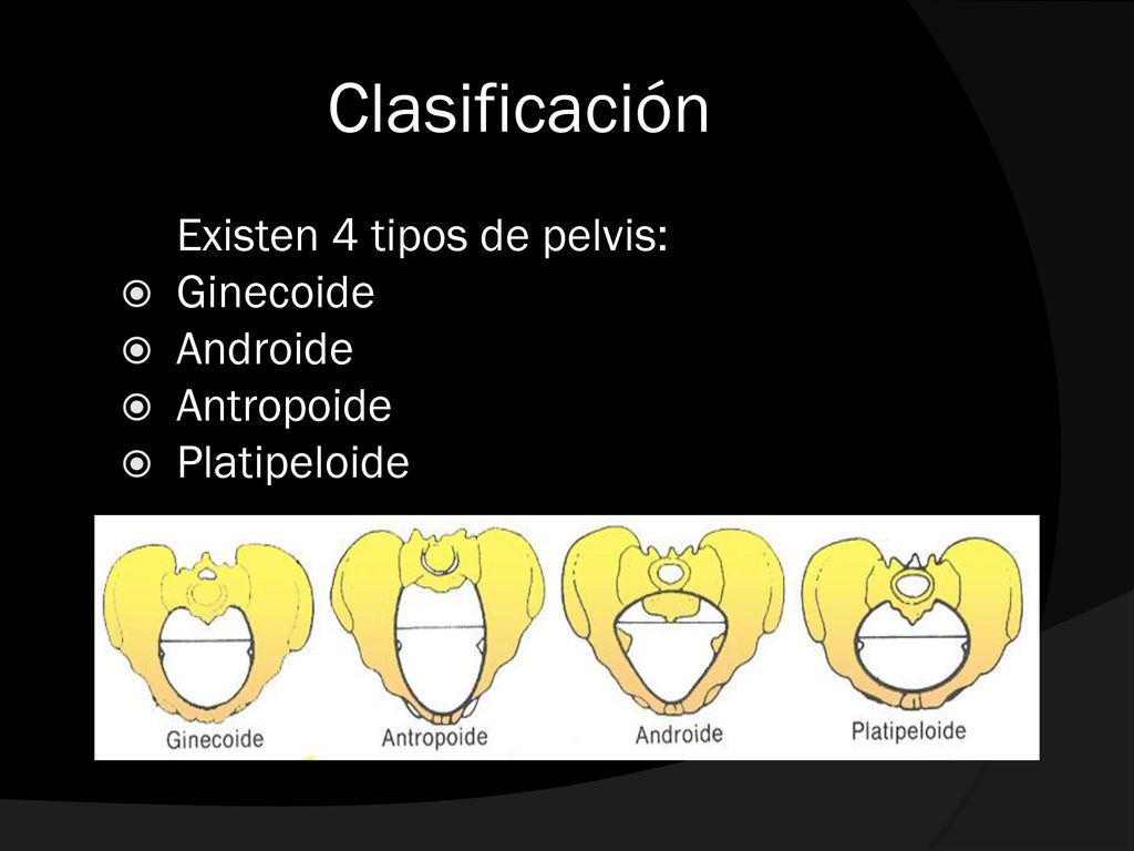 Clasificación Existen 4 tipos de pelvis: Ginecoide Androide Antropoide