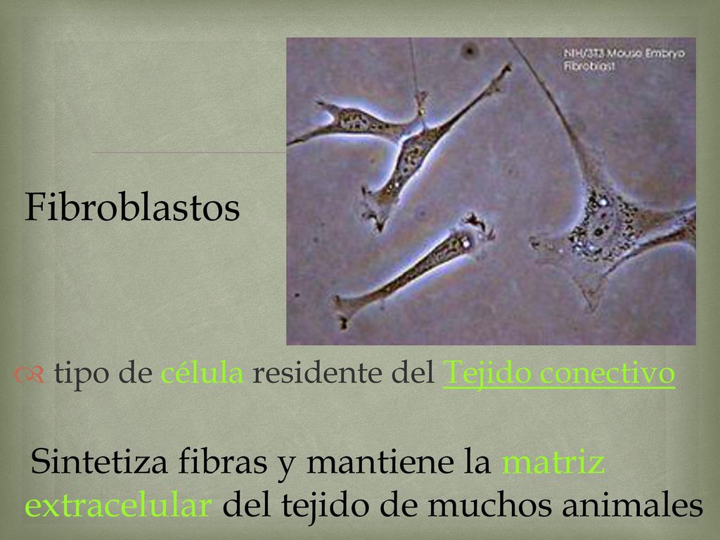 Fibroblastos tipo de célula residente del Tejido conectivo