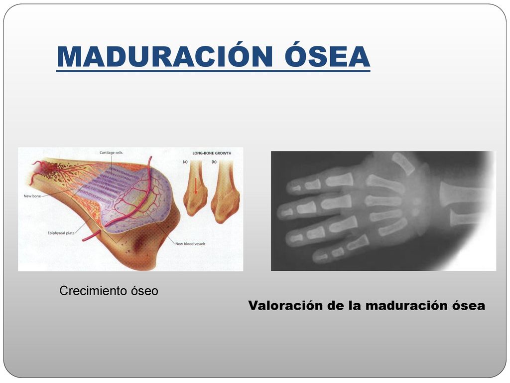 MADURACIÓN ÓSEA Crecimiento óseo Valoración de la maduración ósea