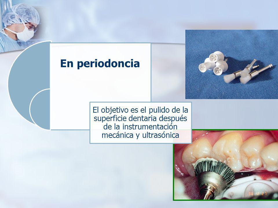 En periodoncia El objetivo es el pulido de la superficie dentaria después de la instrumentación mecánica y ultrasónica.