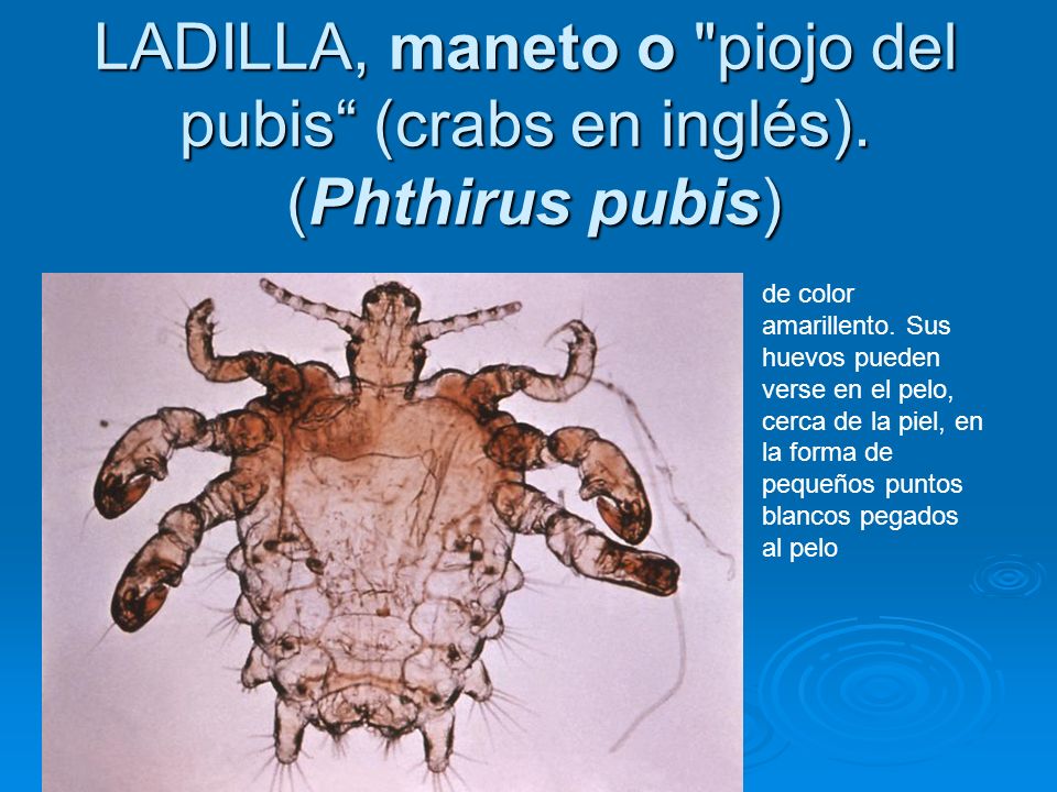 LADILLA, maneto o piojo del pubis (crabs en inglés). (Phthirus pubis)