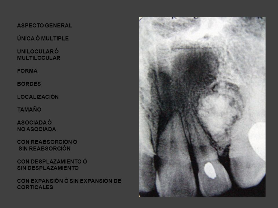 ASPECTO GENERAL ÚNICA Ó MULTIPLE. UNILOCULAR Ó. MULTILOCULAR. FORMA. BORDES. LOCALIZACIÓN. TAMAÑO.