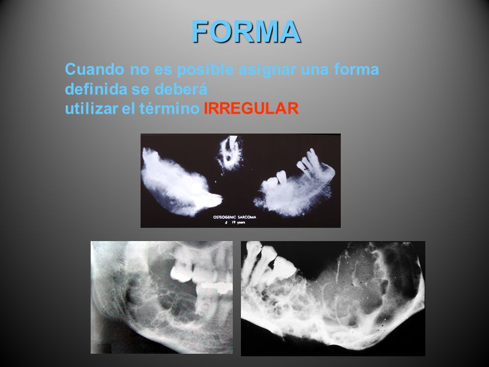 FORMA Cuando no es posible asignar una forma definida se deberá