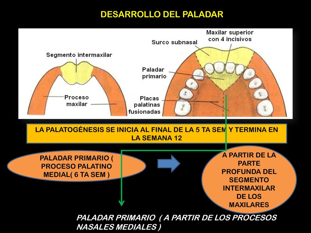PALADAR PRIMARIO ( PROCESO PALATINO MEDIAL( 6 TA SEM )