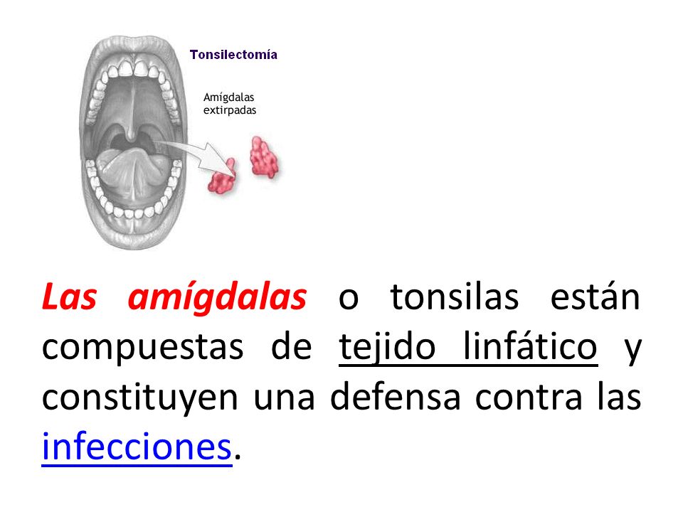 Las amígdalas o tonsilas están compuestas de tejido linfático y constituyen una defensa contra las infecciones.