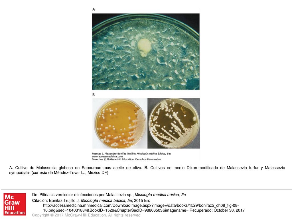 A. Cultivo de Malassezia globosa en Sabouraud más aceite de oliva. B
