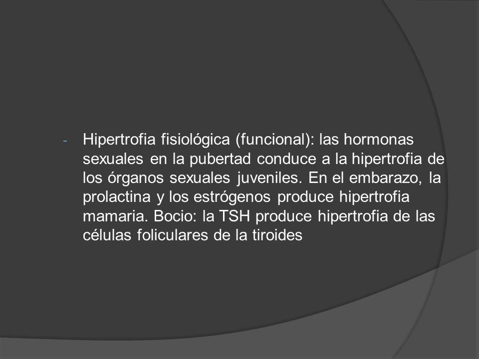 Hipertrofia fisiológica (funcional): las hormonas sexuales en la pubertad conduce a la hipertrofia de los órganos sexuales juveniles.