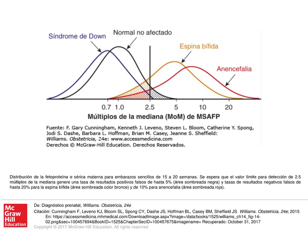 Distribución de la fetoproteína α sérica materna para embarazos sencillos de 15 a 20 semanas. Se espera que el valor límite para detección de 2.5 múltiplos de la mediana genere una tasa de resultados positivos falsos de hasta 5% (área sombreada negra) y tasas de resultados negativos falsos de hasta 20% para la espina bífida (área sombreada color bronce) y de 10% para anencefalia (área sombreada roja).