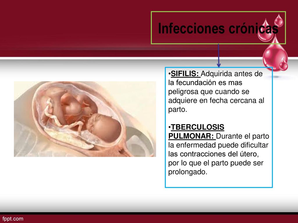 Infecciones crónicas SIFILIS: Adquirida antes de la fecundación es mas peligrosa que cuando se adquiere en fecha cercana al parto.