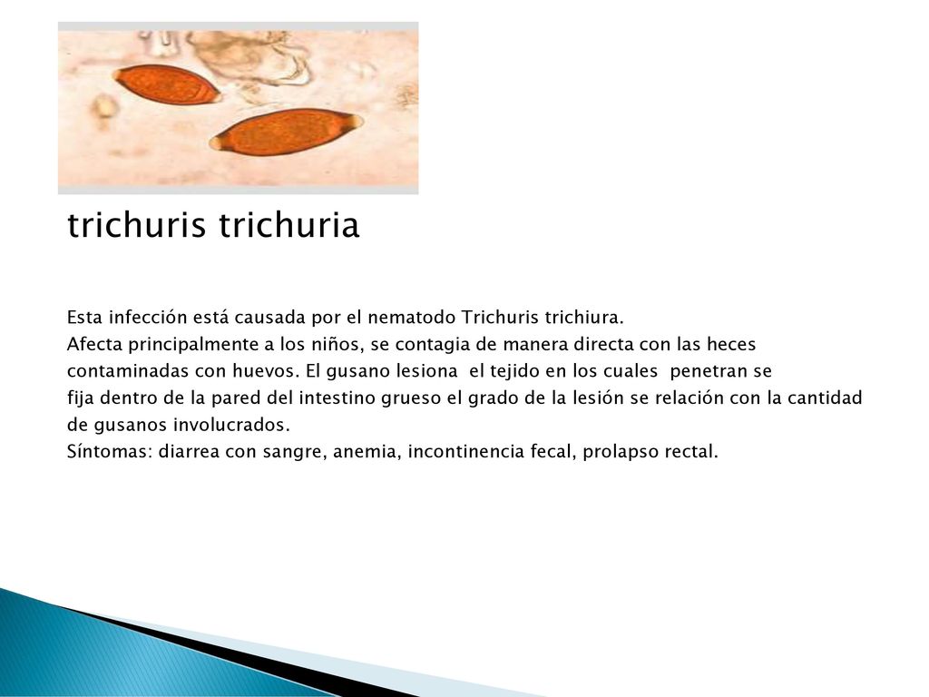 trichuris trichuria Esta infección está causada por el nematodo Trichuris trichiura.