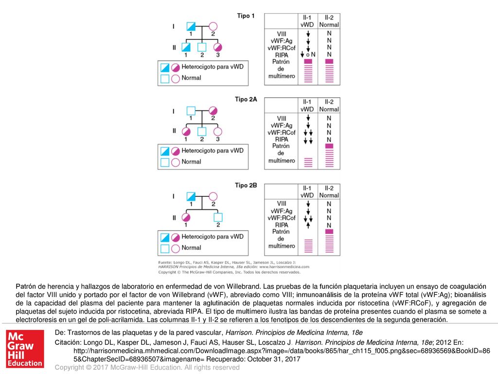 Patrón de herencia y hallazgos de laboratorio en enfermedad de von Willebrand. Las pruebas de la función plaquetaria incluyen un ensayo de coagulación del factor VIII unido y portado por el factor de von Willebrand (vWF), abreviado como VIII; inmunoanálisis de la proteína vWF total (vWF:Ag); bioanálisis de la capacidad del plasma del paciente para mantener la aglutinación de plaquetas normales inducida por ristocetina (vWF:RCoF), y agregación de plaquetas del sujeto inducida por ristocetina, abreviada RIPA. El tipo de multímero ilustra las bandas de proteína presentes cuando el plasma se somete a electroforesis en un gel de poli-acrilamida. Las columnas II-1 y II-2 se refieren a los fenotipos de los descendientes de la segunda generación.