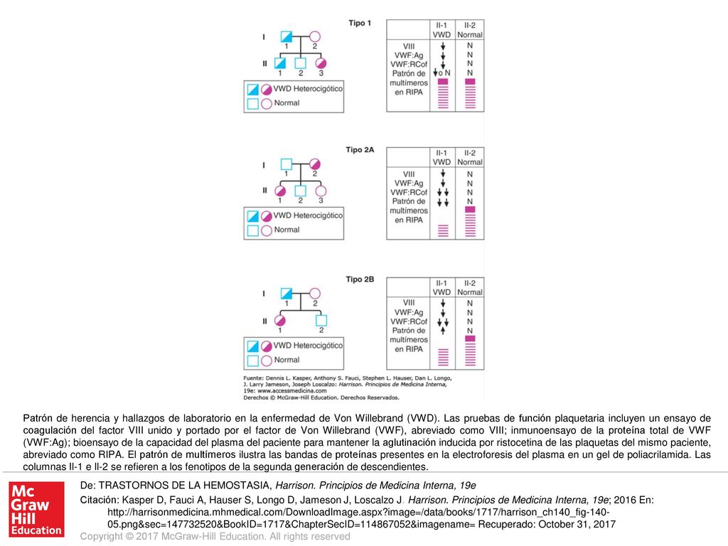 Patrón de herencia y hallazgos de laboratorio en la enfermedad de Von Willebrand (VWD). Las pruebas de función plaquetaria incluyen un ensayo de coagulación del factor VIII unido y portado por el factor de Von Willebrand (VWF), abreviado como VIII; inmunoensayo de la proteína total de VWF (VWF:Ag); bioensayo de la capacidad del plasma del paciente para mantener la aglutinación inducida por ristocetina de las plaquetas del mismo paciente, abreviado como RIPA. El patrón de multímeros ilustra las bandas de proteínas presentes en la electroforesis del plasma en un gel de poliacrilamida. Las columnas Il-1 e Il-2 se refieren a los fenotipos de la segunda generación de descendientes.